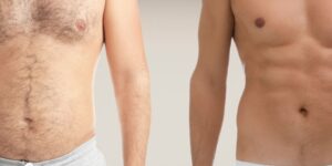Grammosi Muikos Diaxirismos Proteini Diatrofi