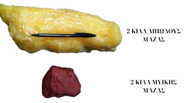Lipos Enantion Myes Megethos Sistasi Somatos Diaitologos